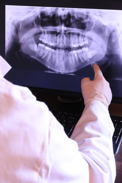 Best Emergency Wisdom Teeth Removal in Sapulpa, OK